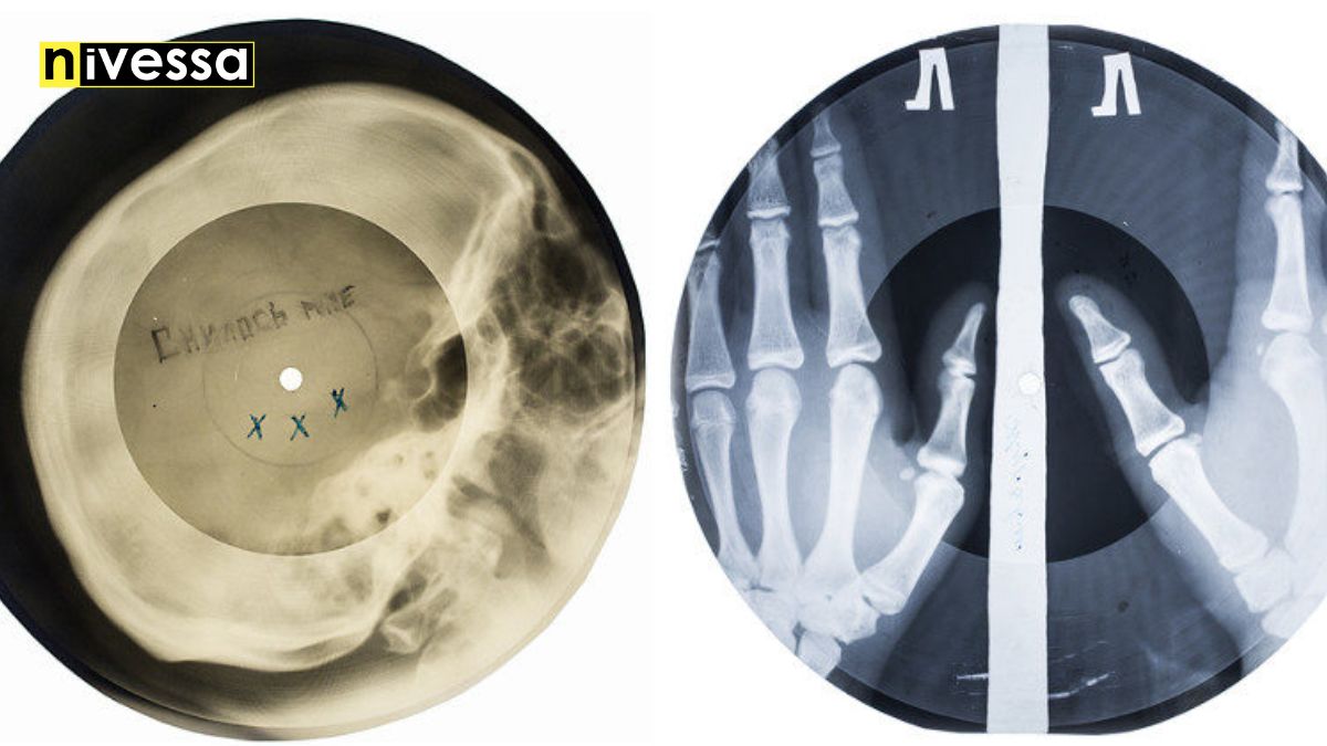 The Intriguing World of Russian XRay Vinyl Records Nivessa Vinyl